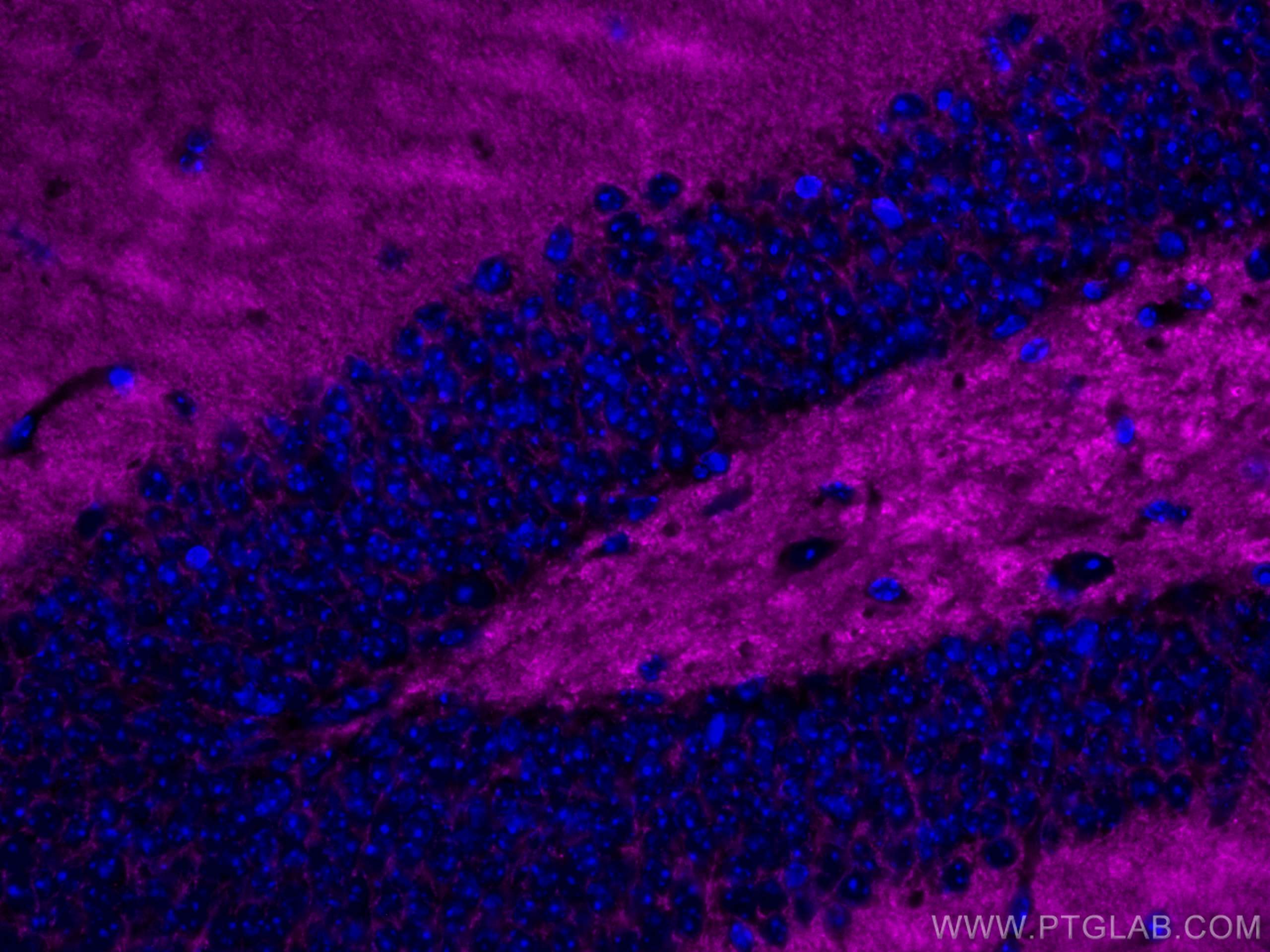 IF Staining of mouse brain using CL647-67864