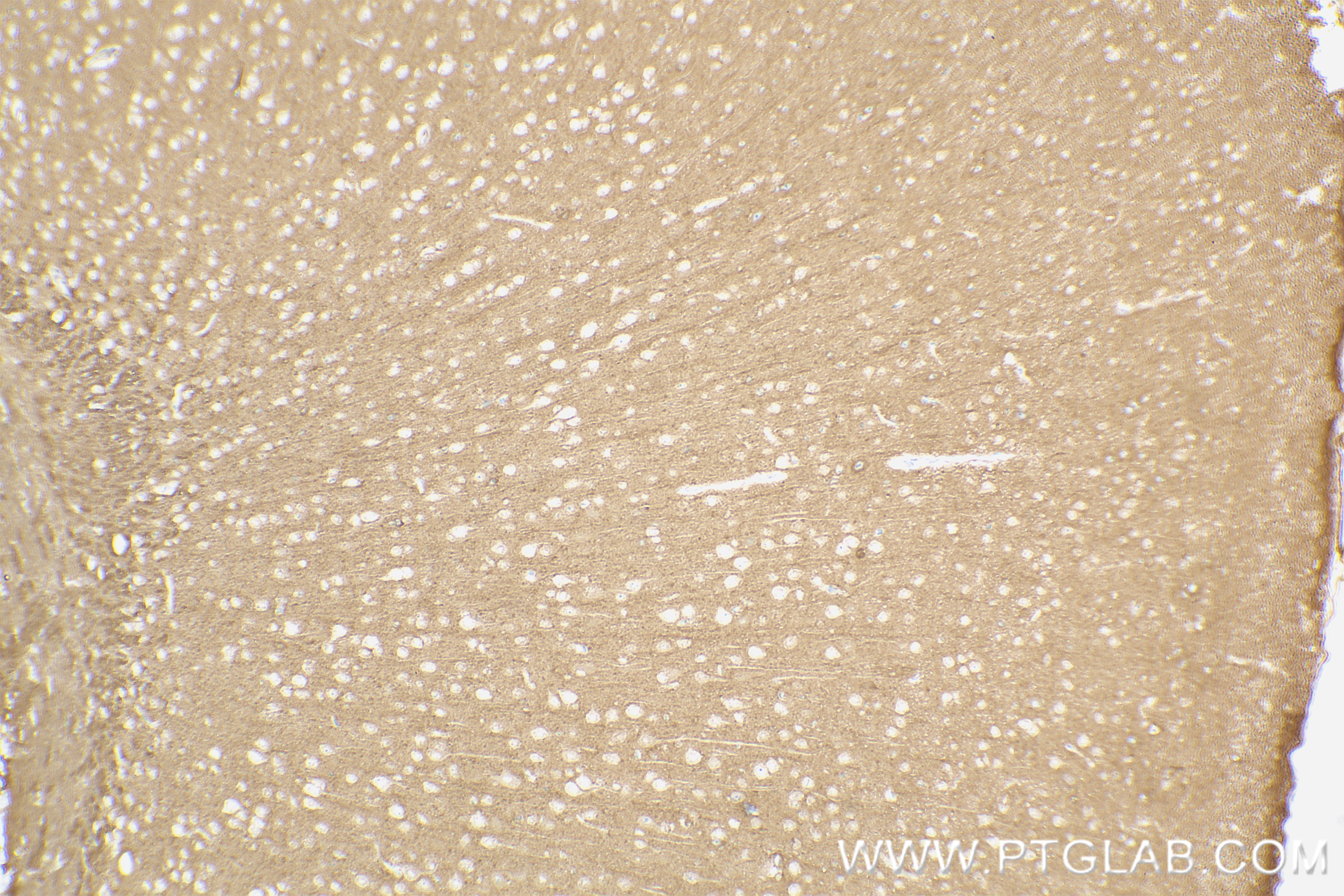 IHC staining of mouse brain using 83637-4-RR