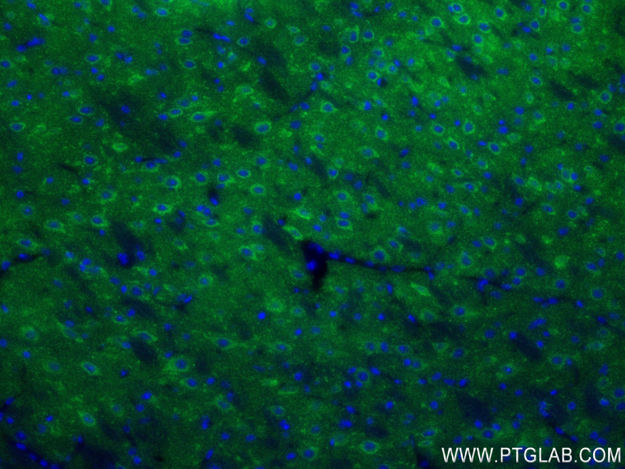IF Staining of mouse brain using 84452-1-RR (same clone as 84452-1-PBS)