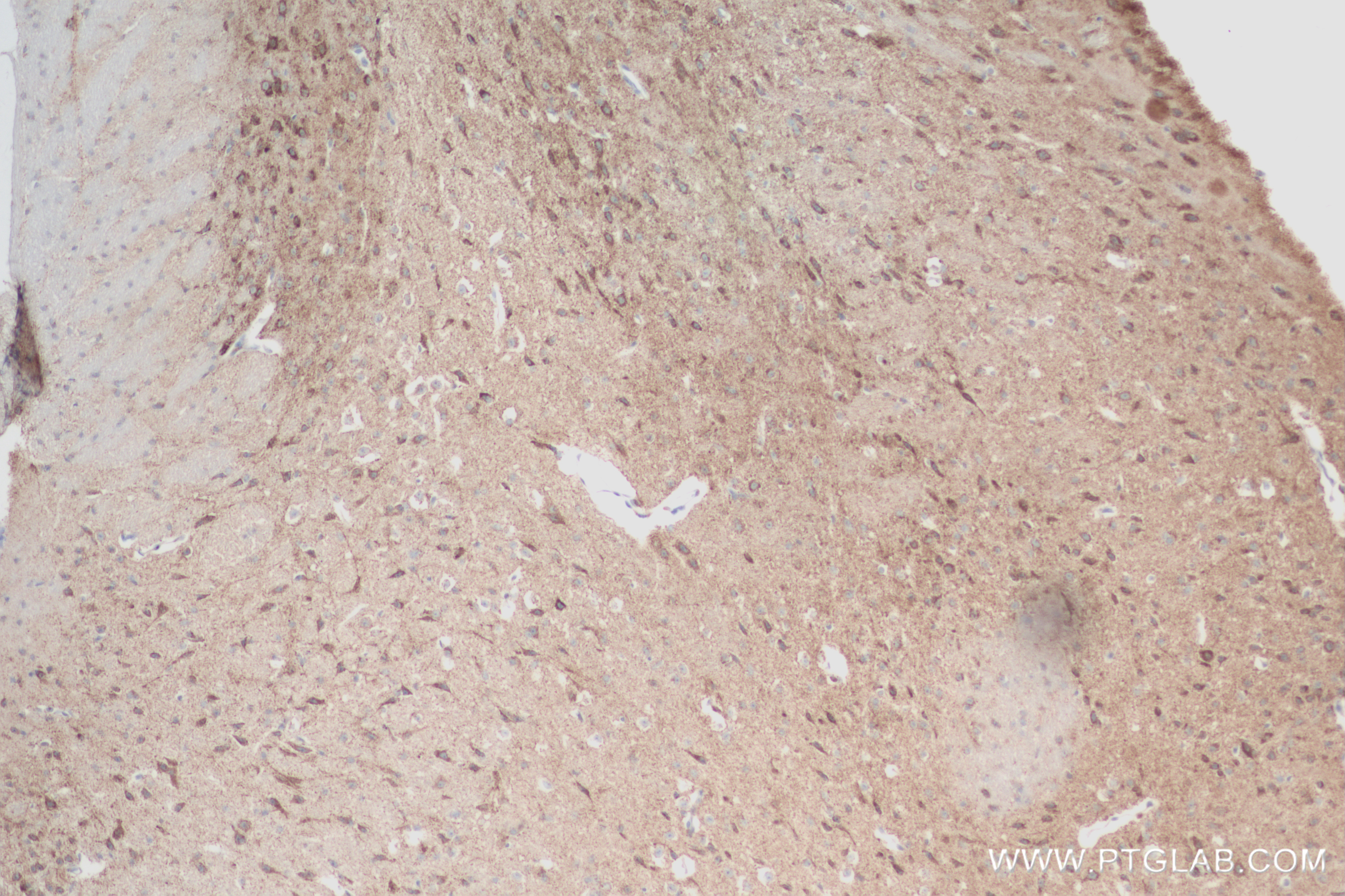 IHC staining of mouse brain using 84452-1-RR (same clone as 84452-1-PBS)
