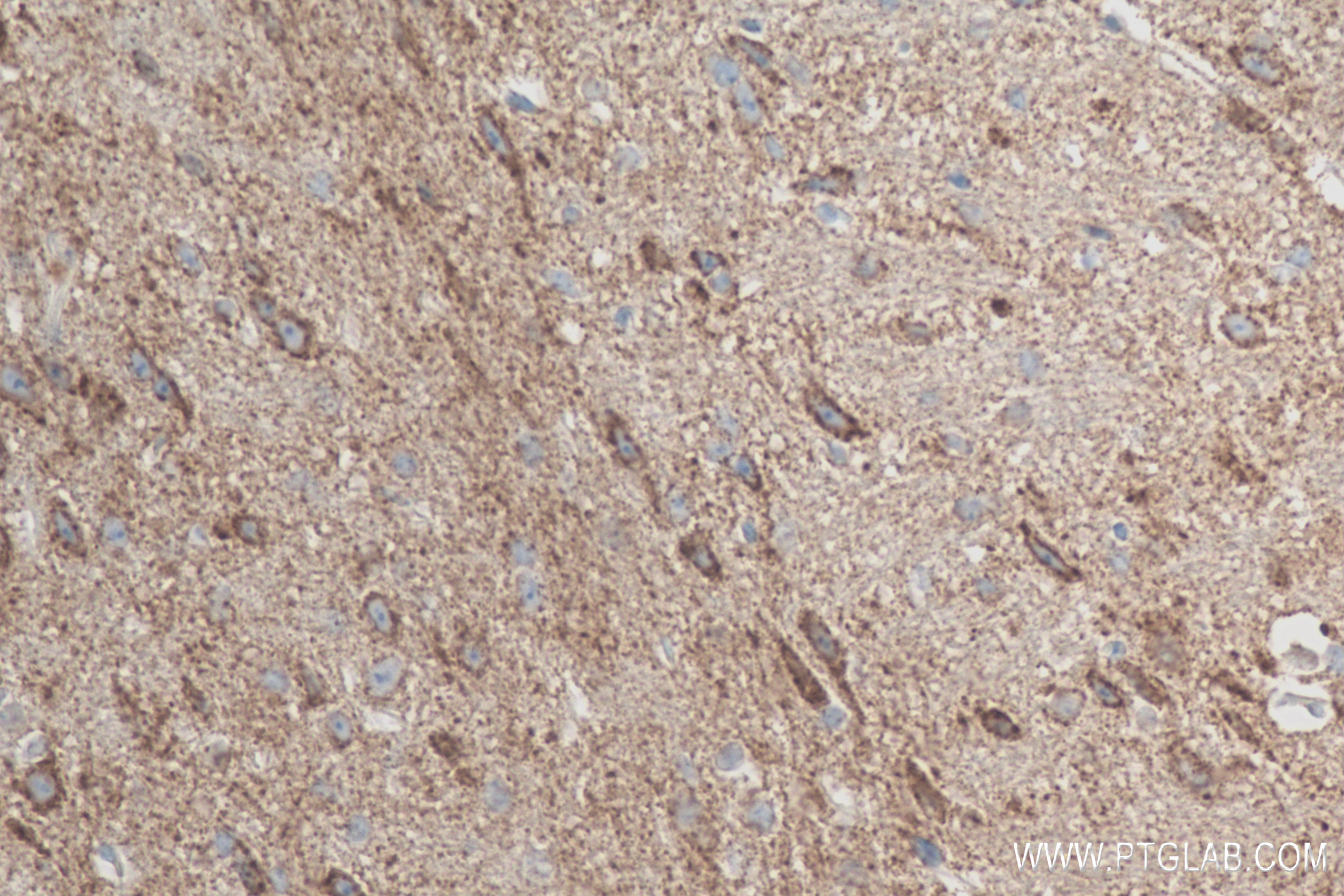 IHC staining of mouse brain using 84452-1-RR (same clone as 84452-1-PBS)