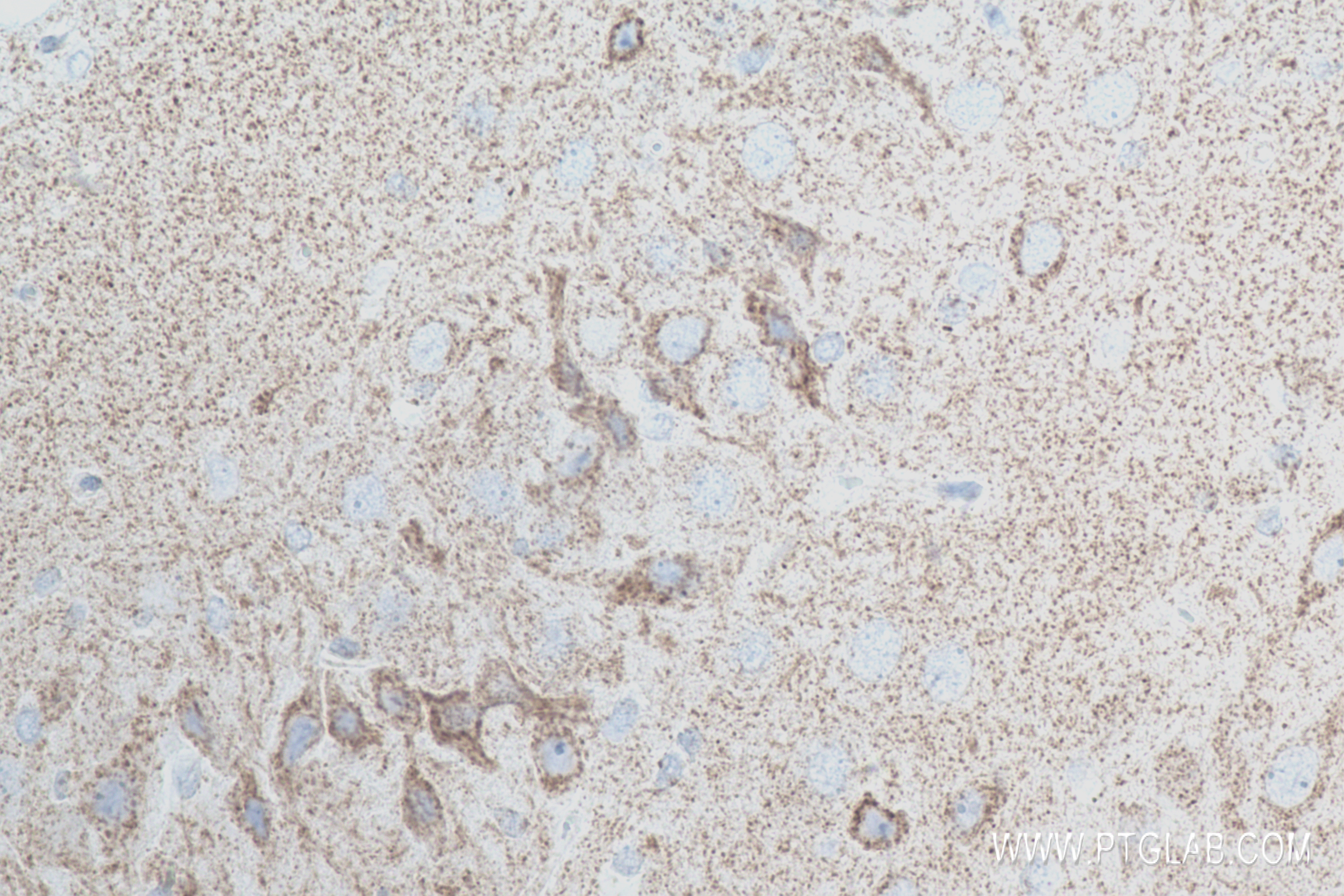 Synaptotagmin-5