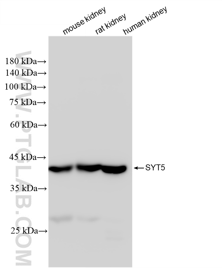 WB analysis using 84452-1-RR (same clone as 84452-1-PBS)