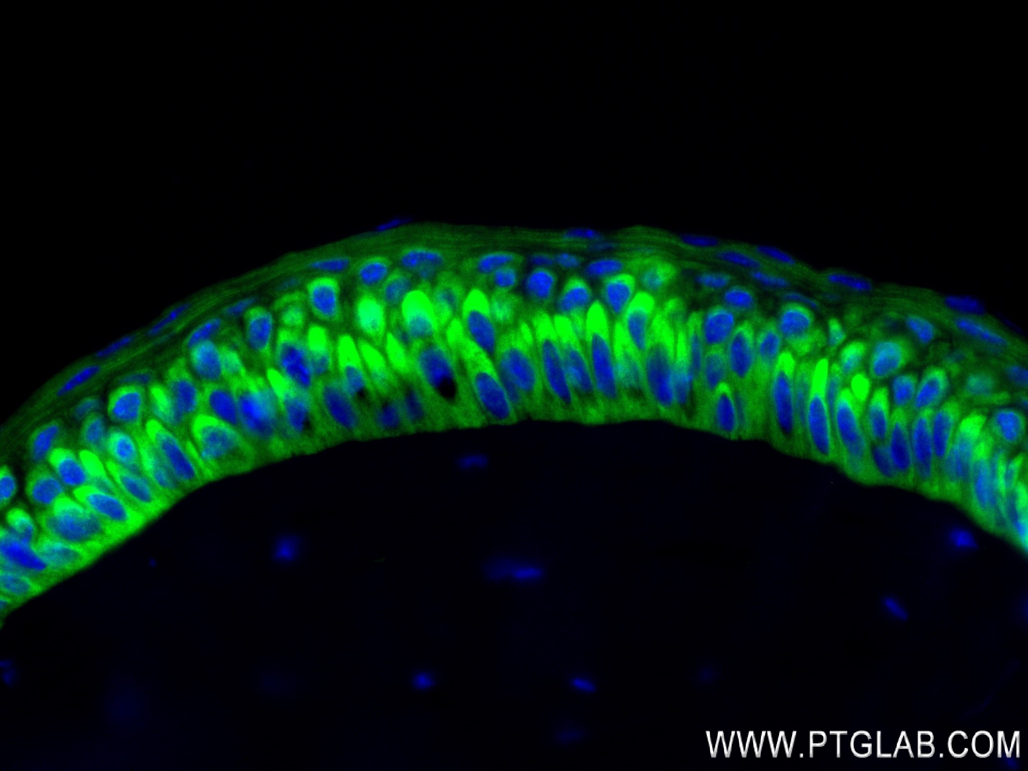 IF Staining of mouse retina using 84123-3-RR