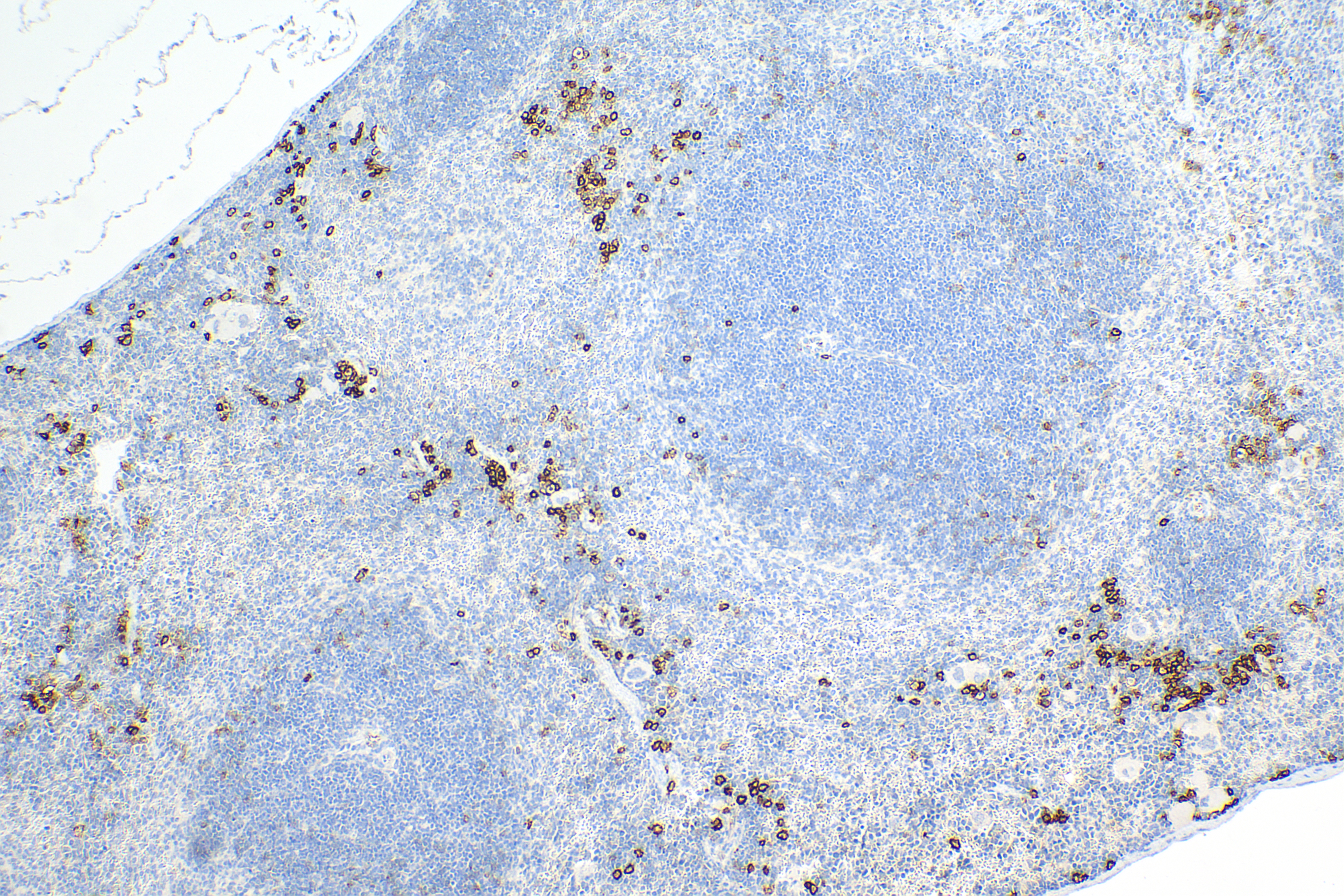IHC staining of mouse spleen using 84069-8-RR