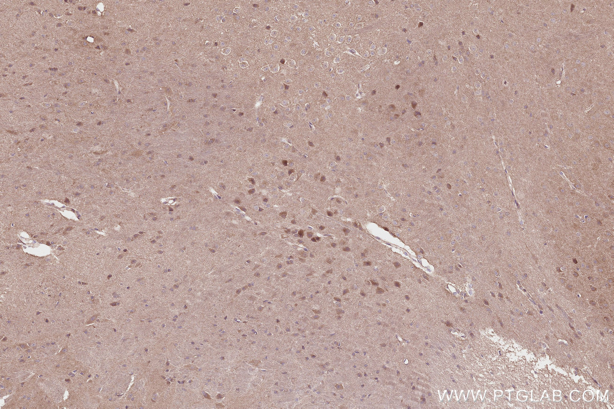 IHC staining of mouse brain using 27749-1-AP IHC staining of mouse brain using 27749-1-AP