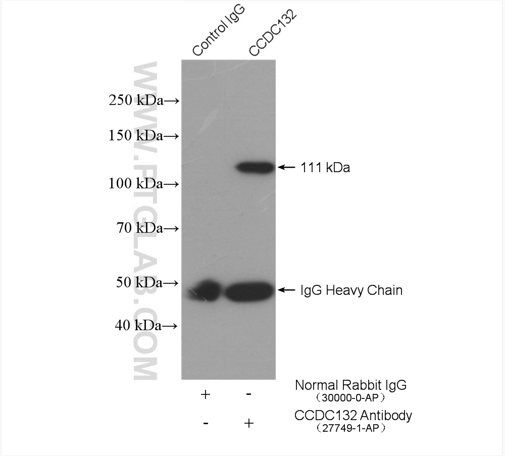 IP experiment of mouse brain using 27749-1-AP