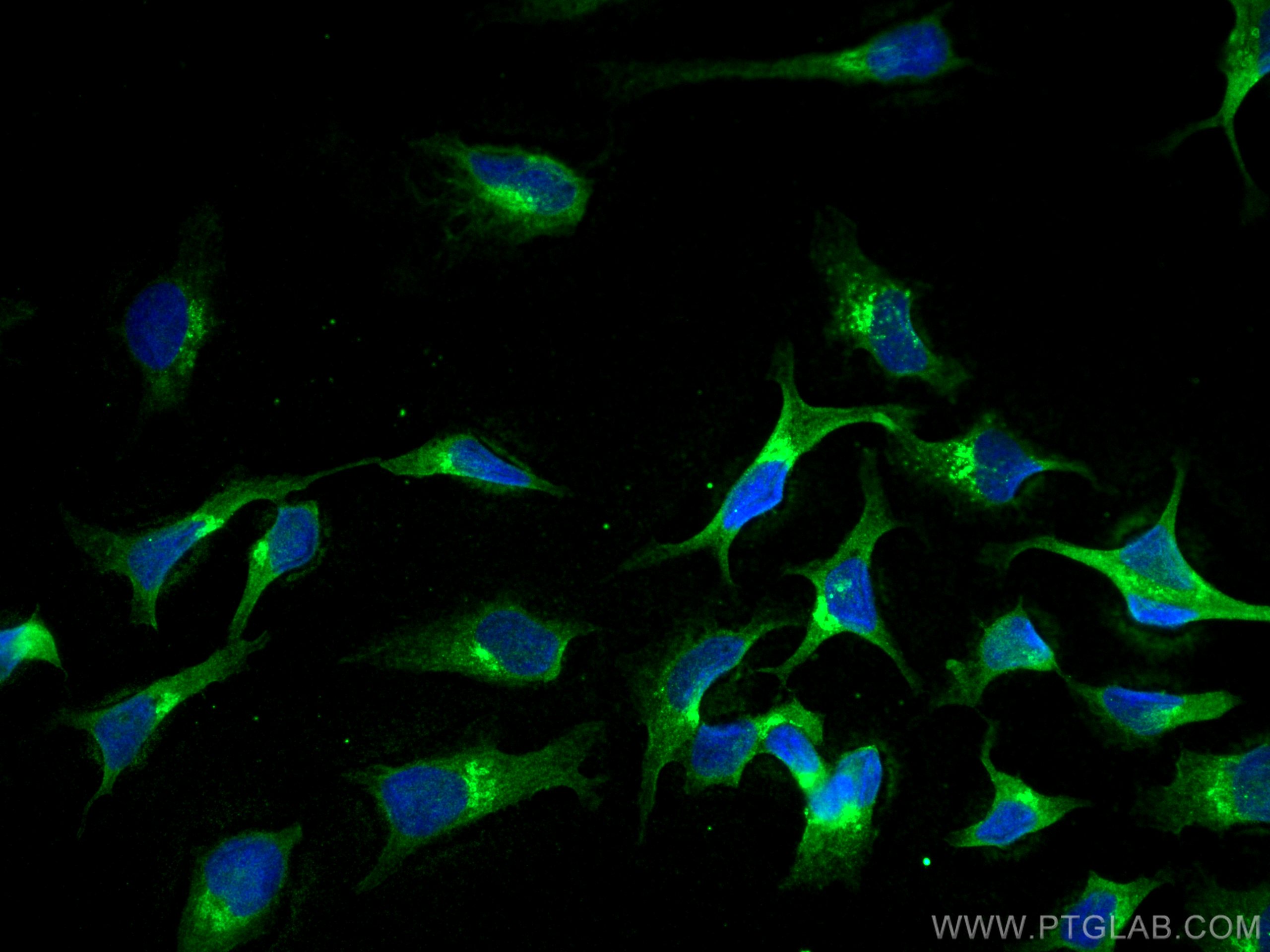 IF Staining of HeLa using 66821-1-Ig (same clone as 66821-1-PBS)