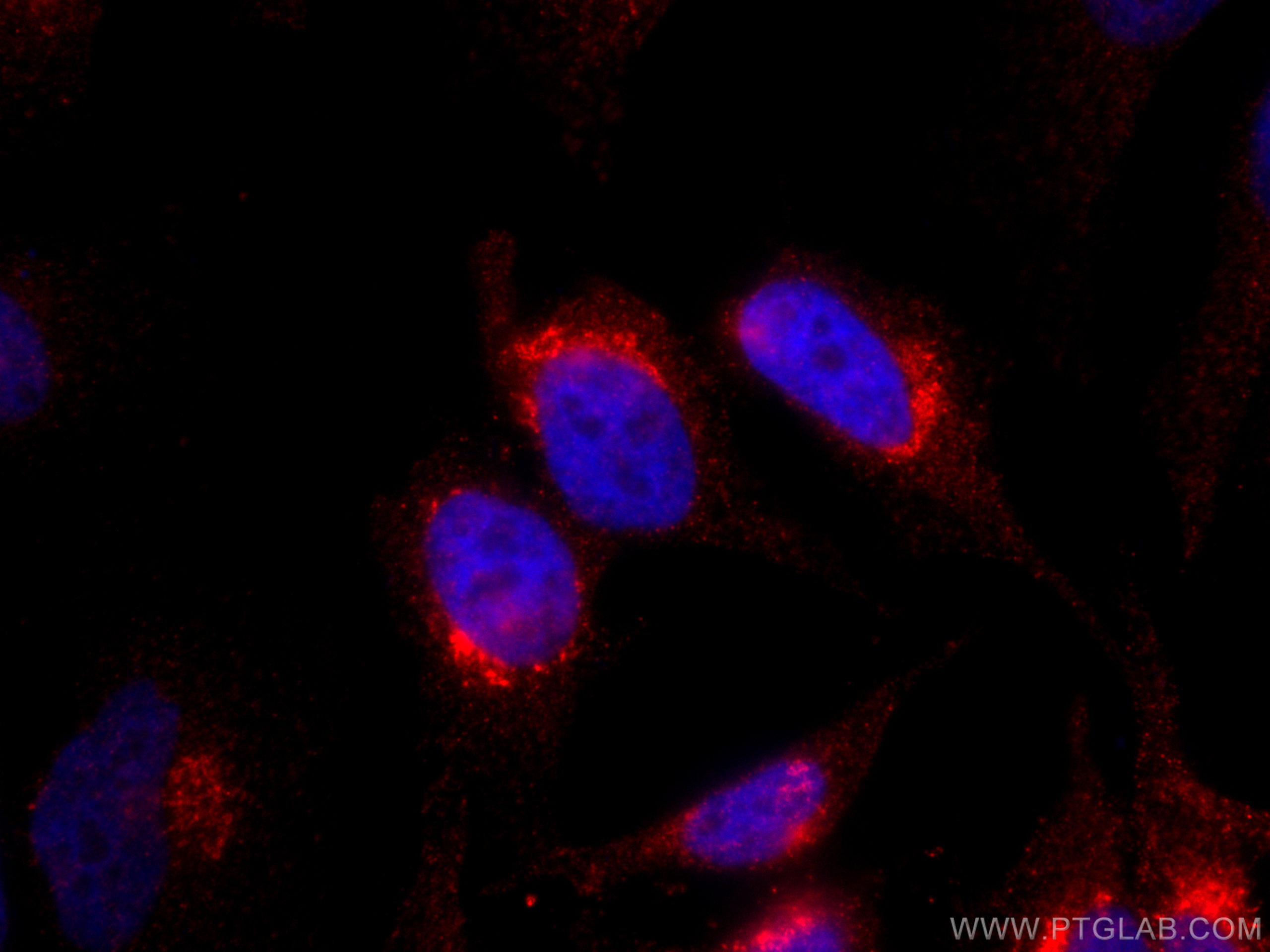 IF Staining of HeLa using CL594-66821