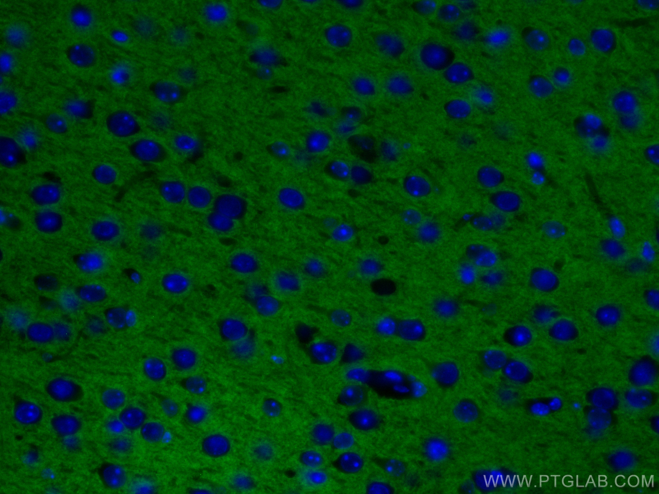 IF Staining of mouse brain using CL488-66437