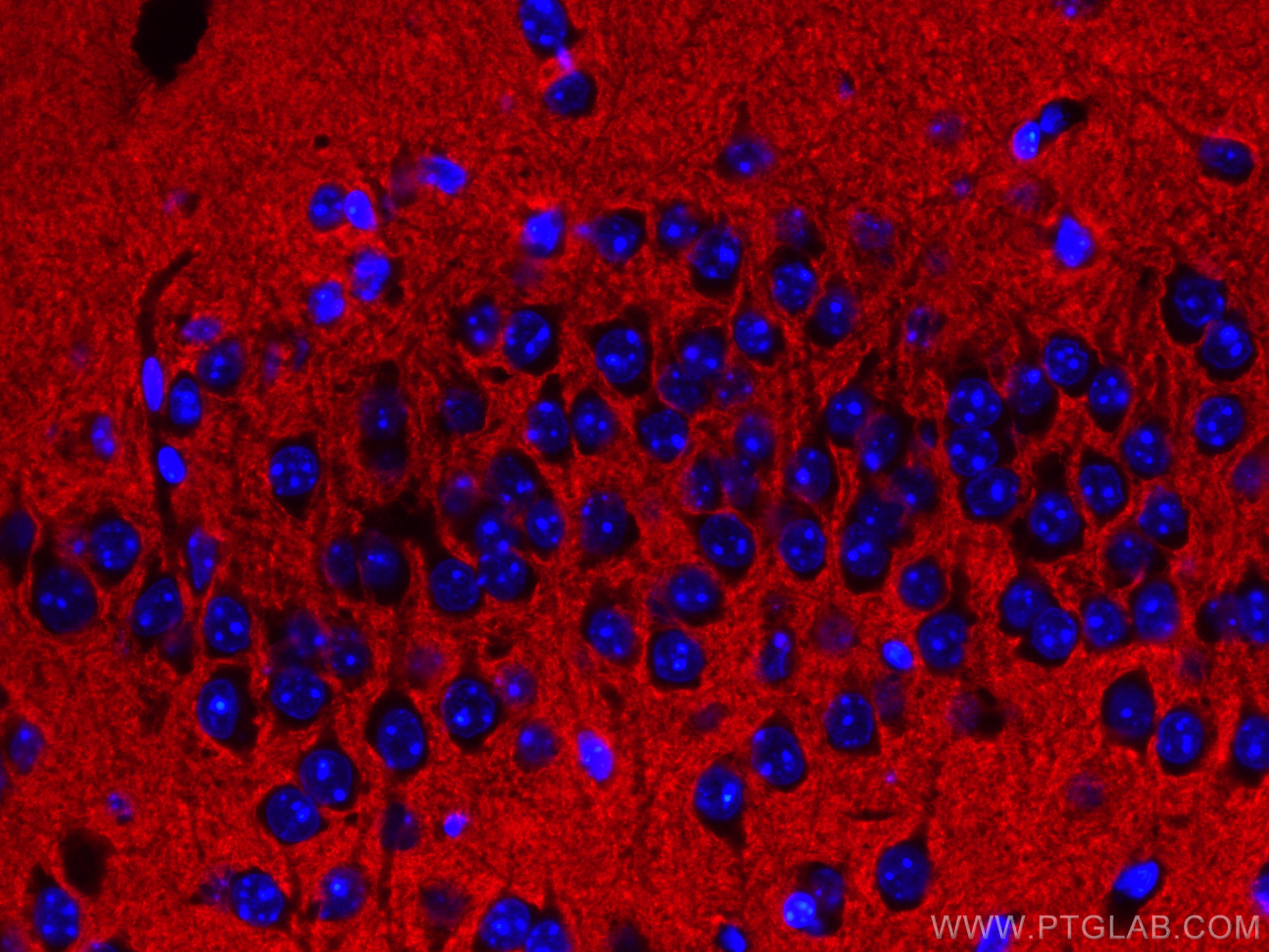 IF Staining of mouse brain using CL594-66437