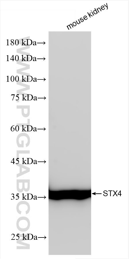 WB analysis using 86181-1-RR (same clone as 86181-1-PBS)