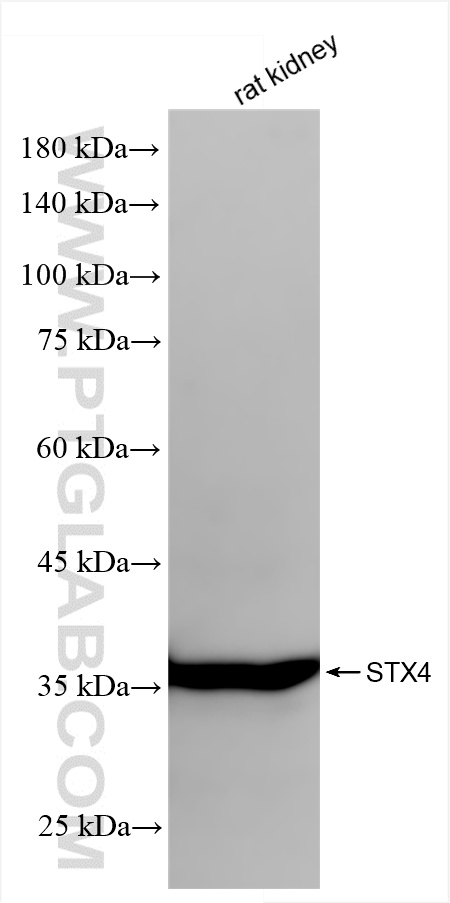 WB analysis of rat kidney using 86181-1-RR (same clone as 86181-1-PBS)