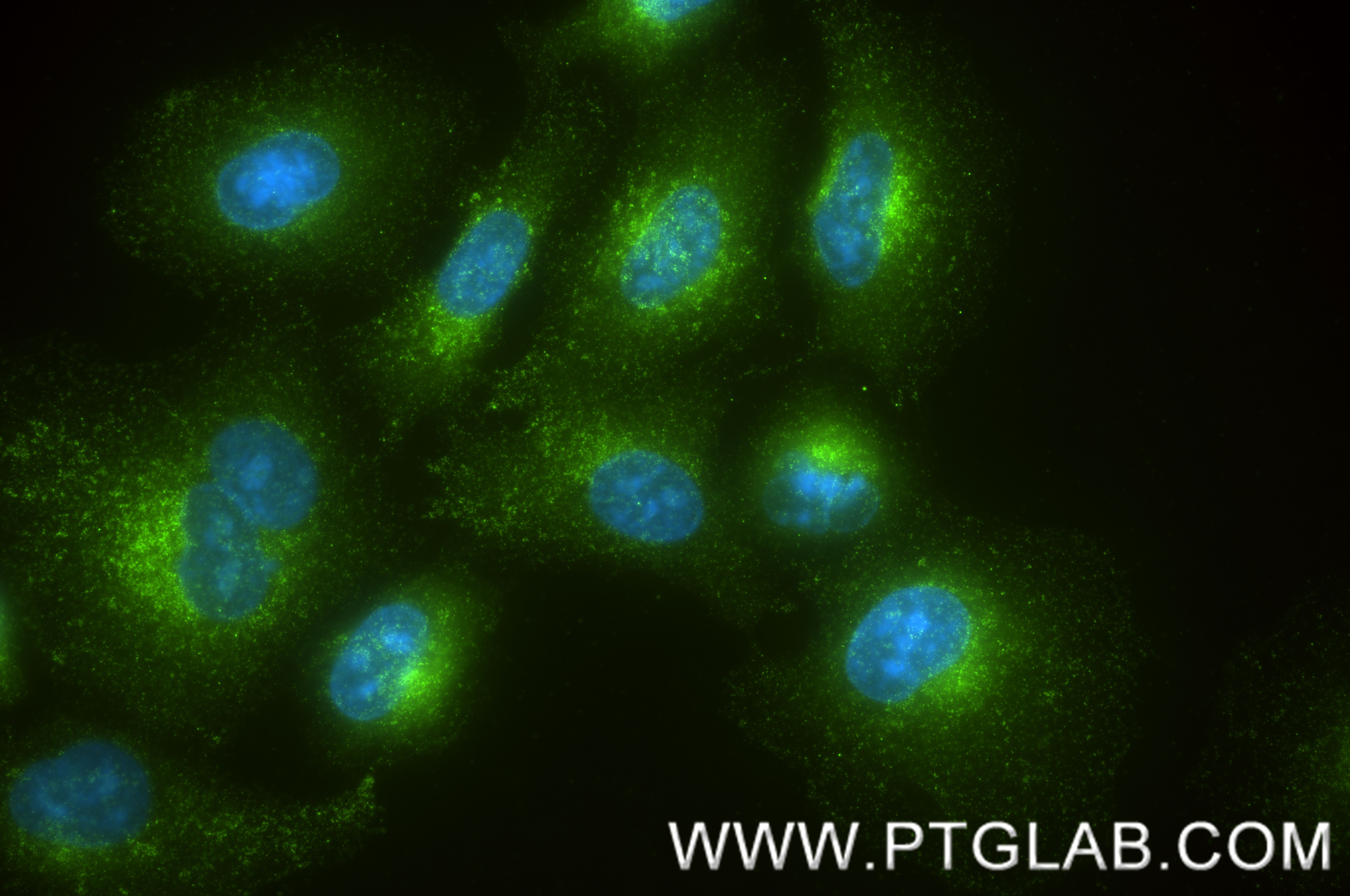 IF Staining of A549 using 87915-1-RR (same clone as 87915-1-PBS) IF Staining of A549 using 87915-1-RR (same clone as 87915-1-PBS)