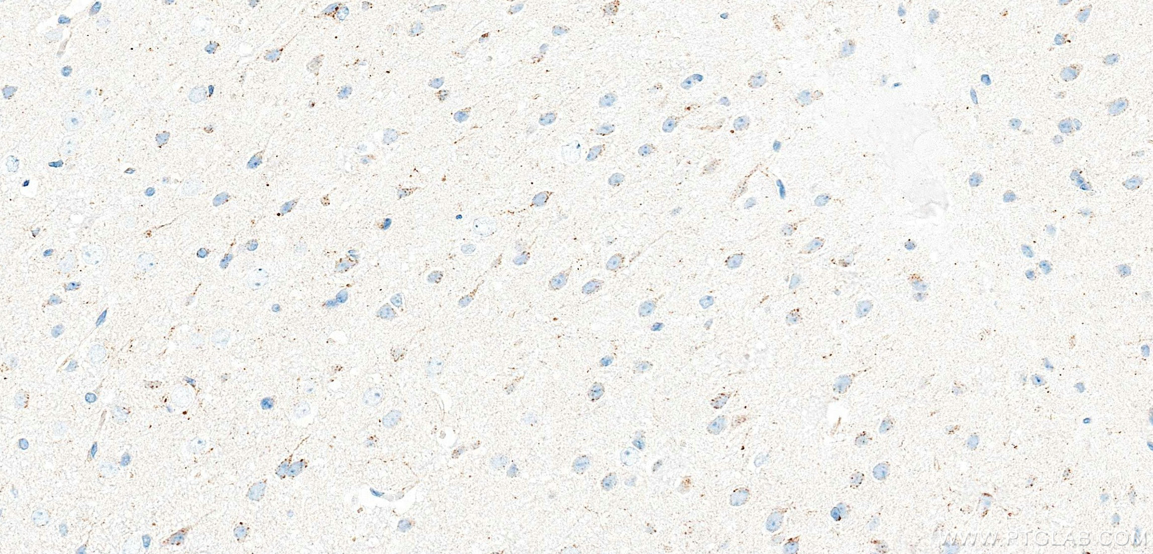 IHC staining of mouse brain using 87915-1-RR (same clone as 87915-1-PBS) IHC staining of mouse brain using 87915-1-RR (same clone as 87915-1-PBS)