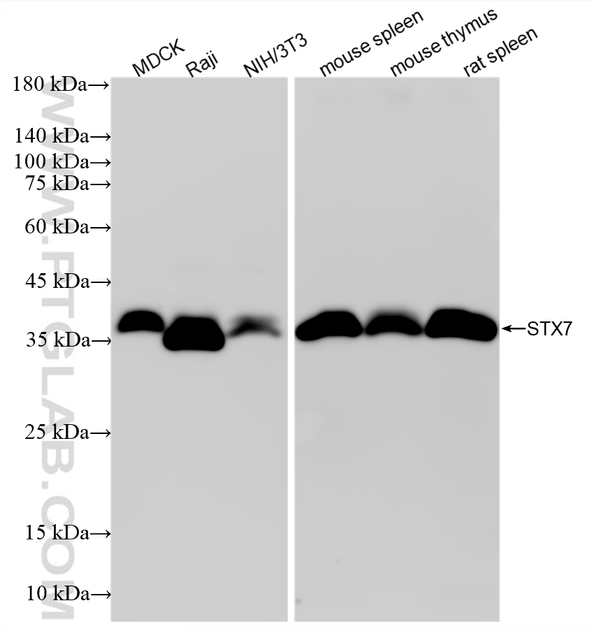 WB analysis using 87915-1-RR (same clone as 87915-1-PBS) WB analysis using 87915-1-RR (same clone as 87915-1-PBS)