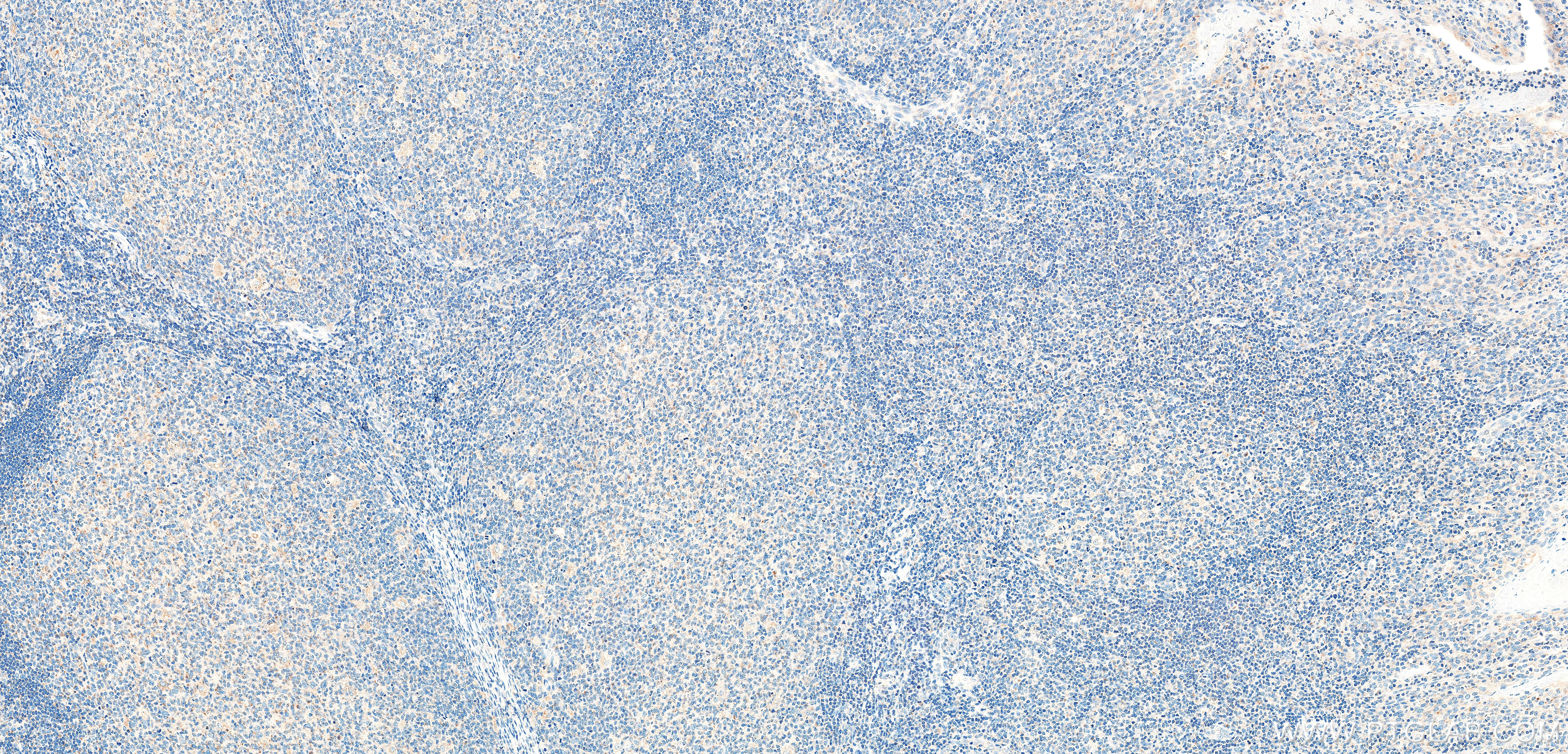 IHC staining of human tonsil using 86580-1-RR (same clone as 86580-1-PBS) IHC staining of human tonsil using 86580-1-RR (same clone as 86580-1-PBS)