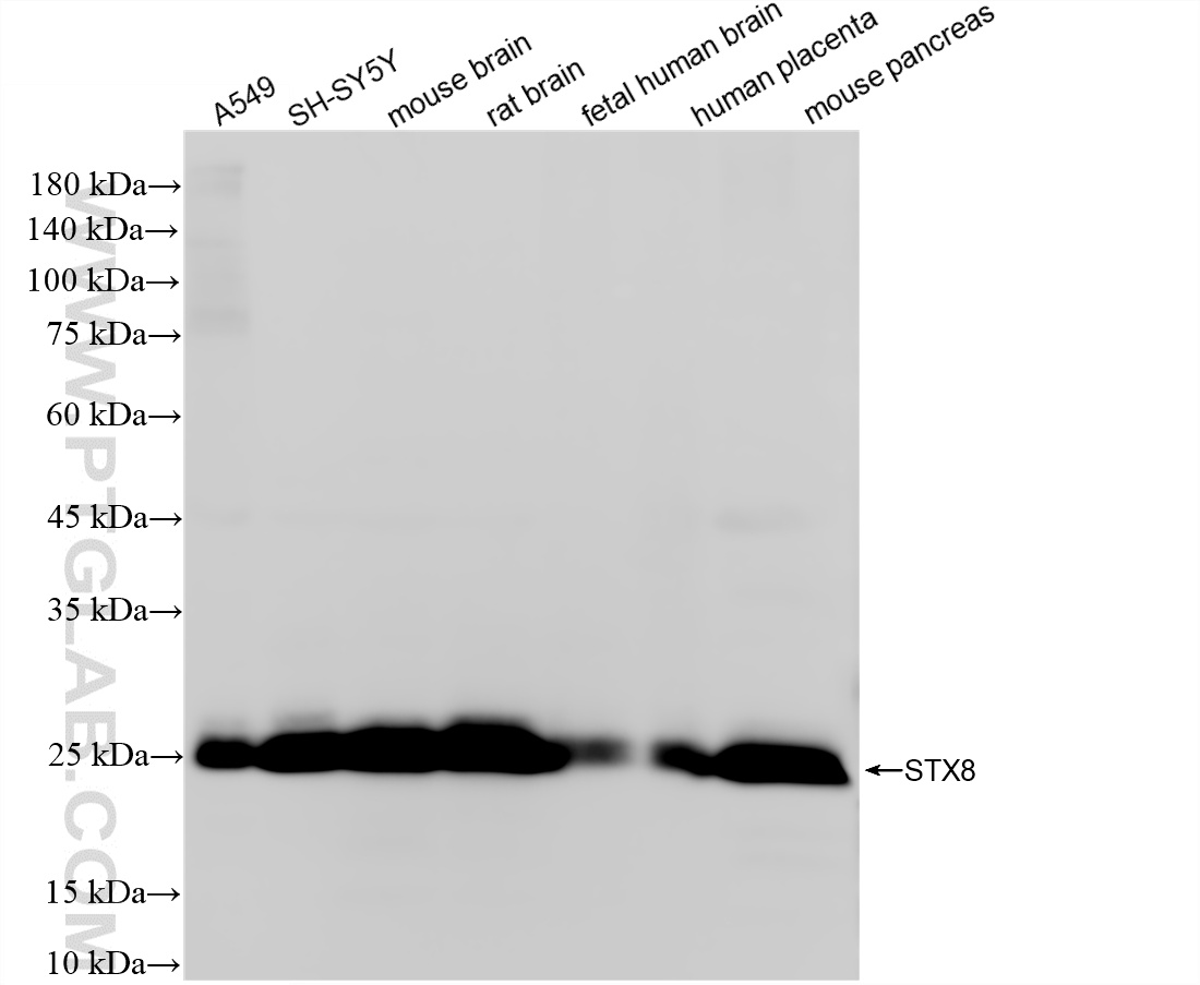 Various lysates were subjected to SDS PAGE followed by western blot with <a class='green' href='/productredirect?CatalogNo=86580-1-RR' target='_blank'>86580-1-RR</a> (STX8 antibody) at dilution of 1:30000 incubated at room temperature for 1.5 hours. This data was developed using the same antibody clone with 86580-1-PBS in a different storage buffer formulation. WB analysis using 86580-1-RR (same clone as 86580-1-PBS)