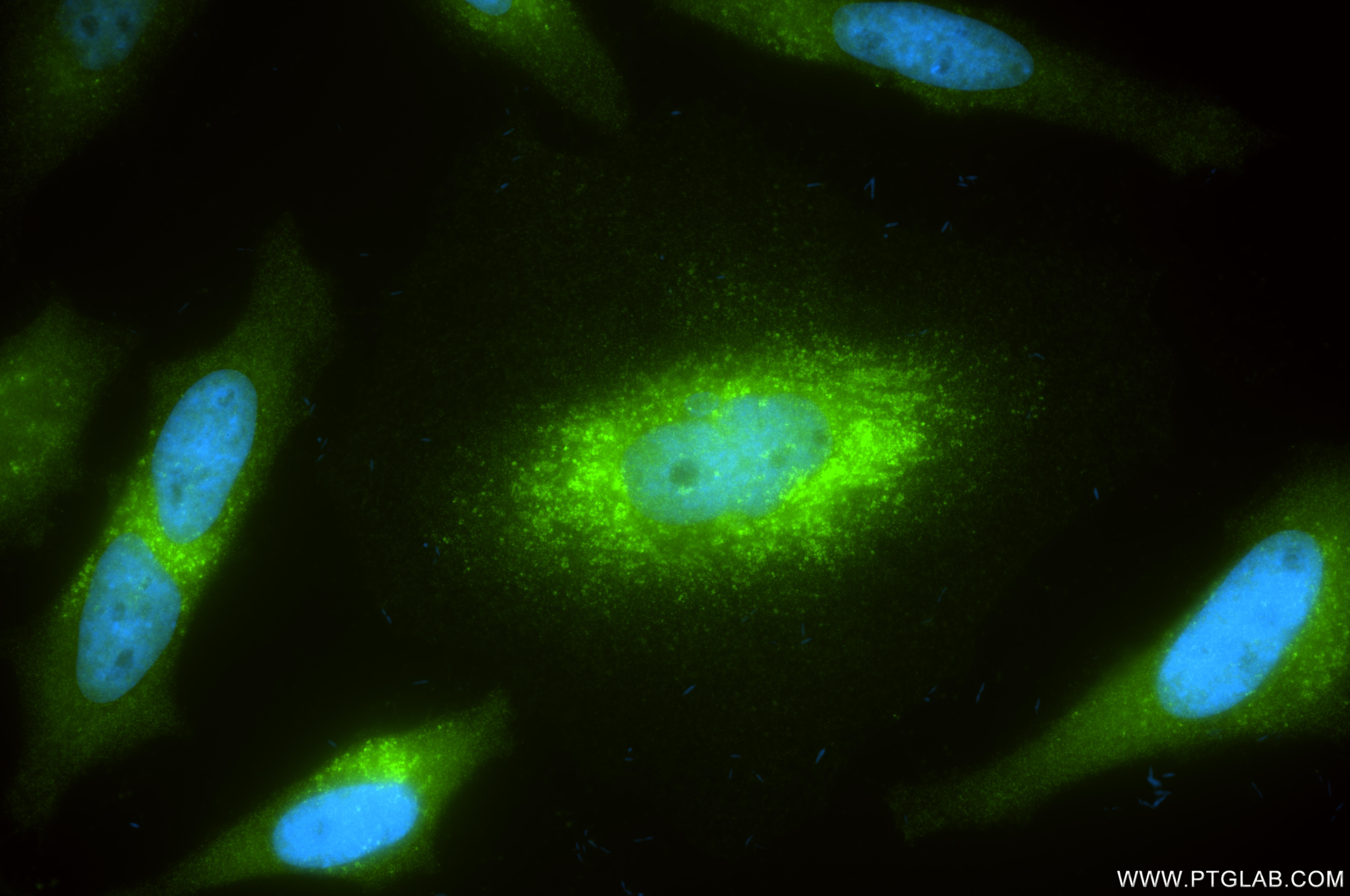 IF Staining of HeLa using 86968-1-RR (same clone as 86968-1-PBS)