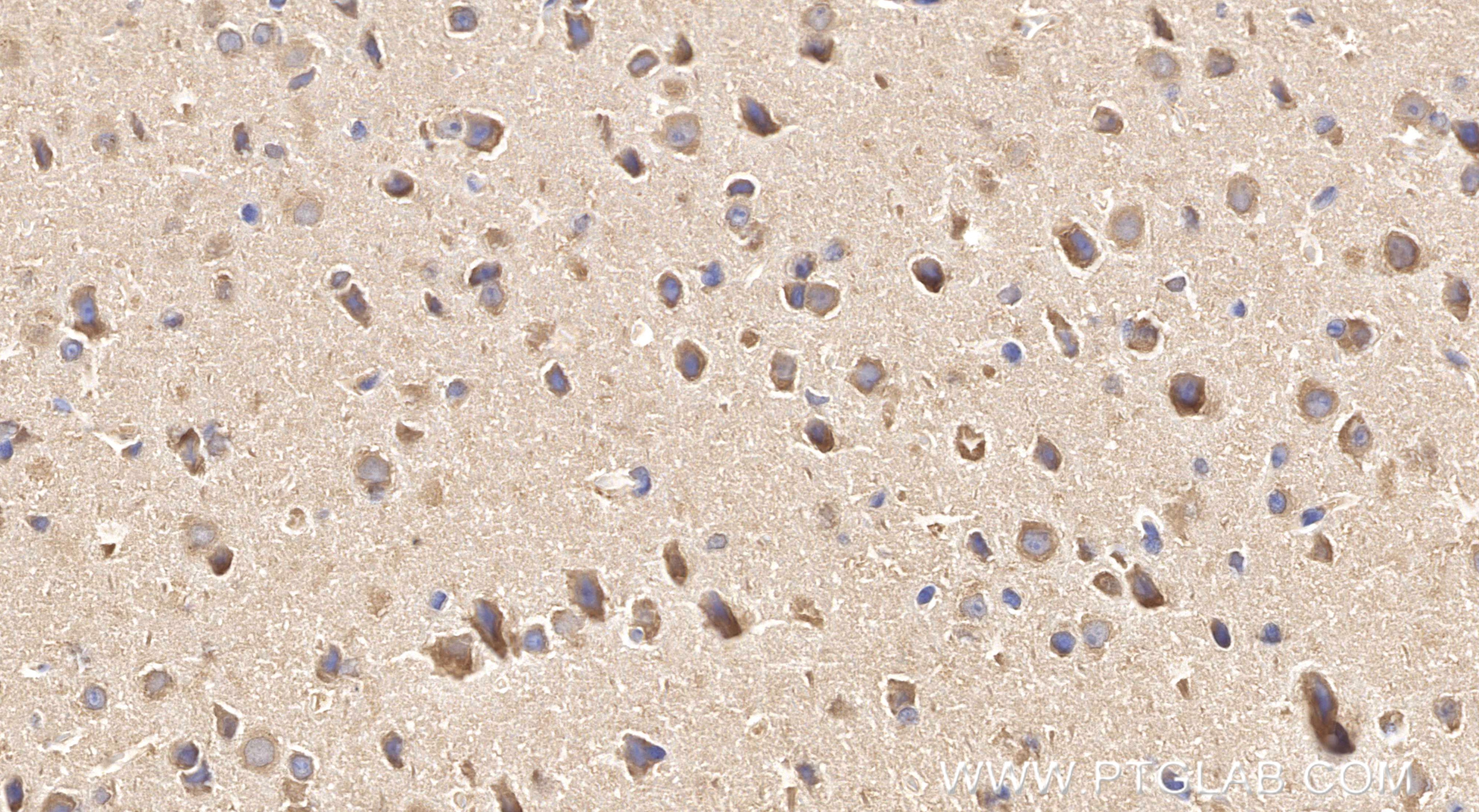 IHC staining of mouse brain using 86968-1-RR (same clone as 86968-1-PBS)