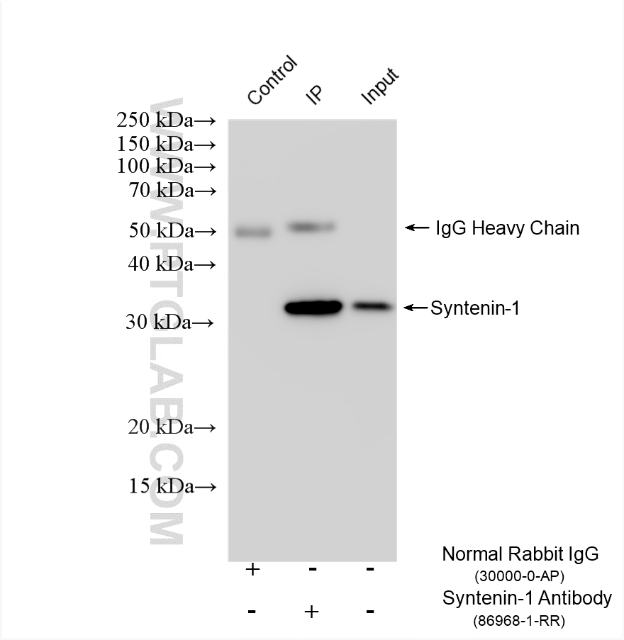 IP experiment of HeLa using 86968-1-RR (same clone as 86968-1-PBS)