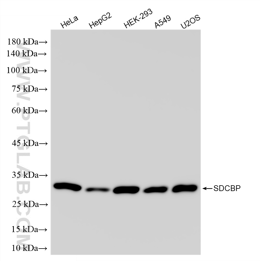 WB analysis using 86968-1-RR (same clone as 86968-1-PBS)
