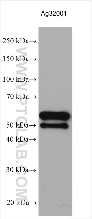 T7 RNA polymerase