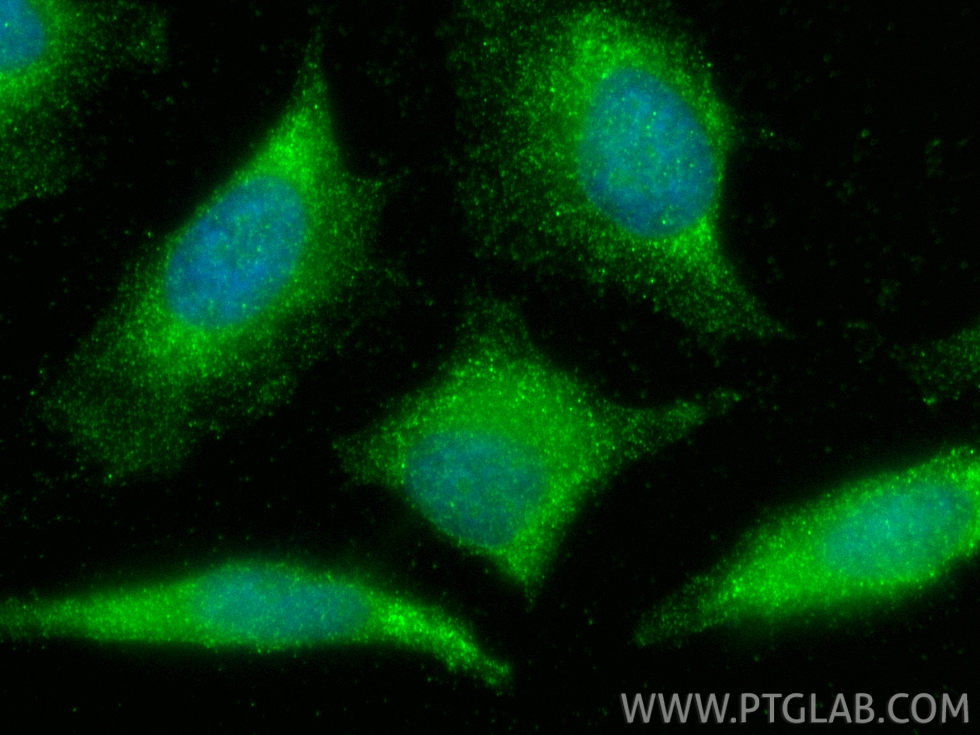 IF Staining of HeLa using 27566-1-AP IF Staining of HeLa using 27566-1-AP