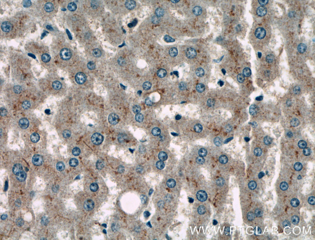 IHC staining of human liver using 27566-1-AP