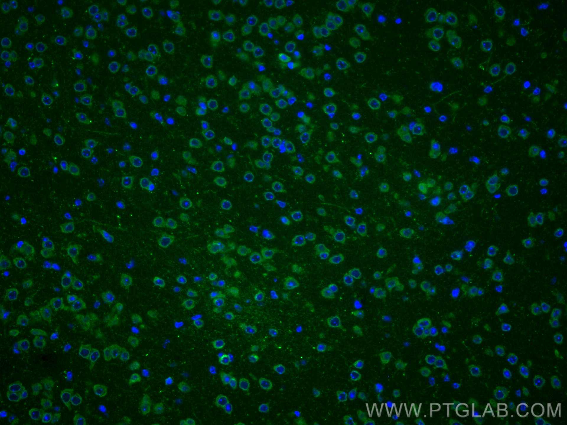 IF Staining of mouse brain using 13839-1-AP