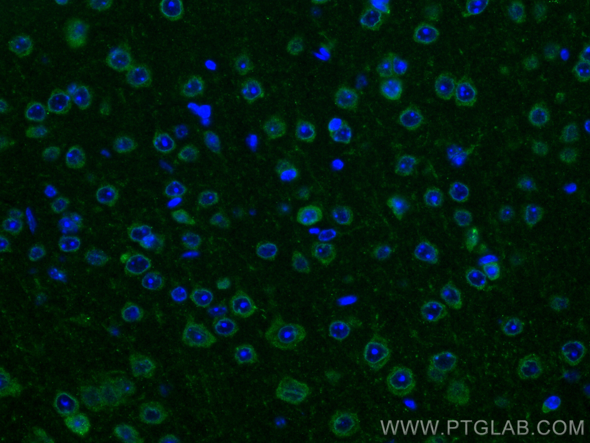 IF Staining of mouse brain using 13839-1-AP