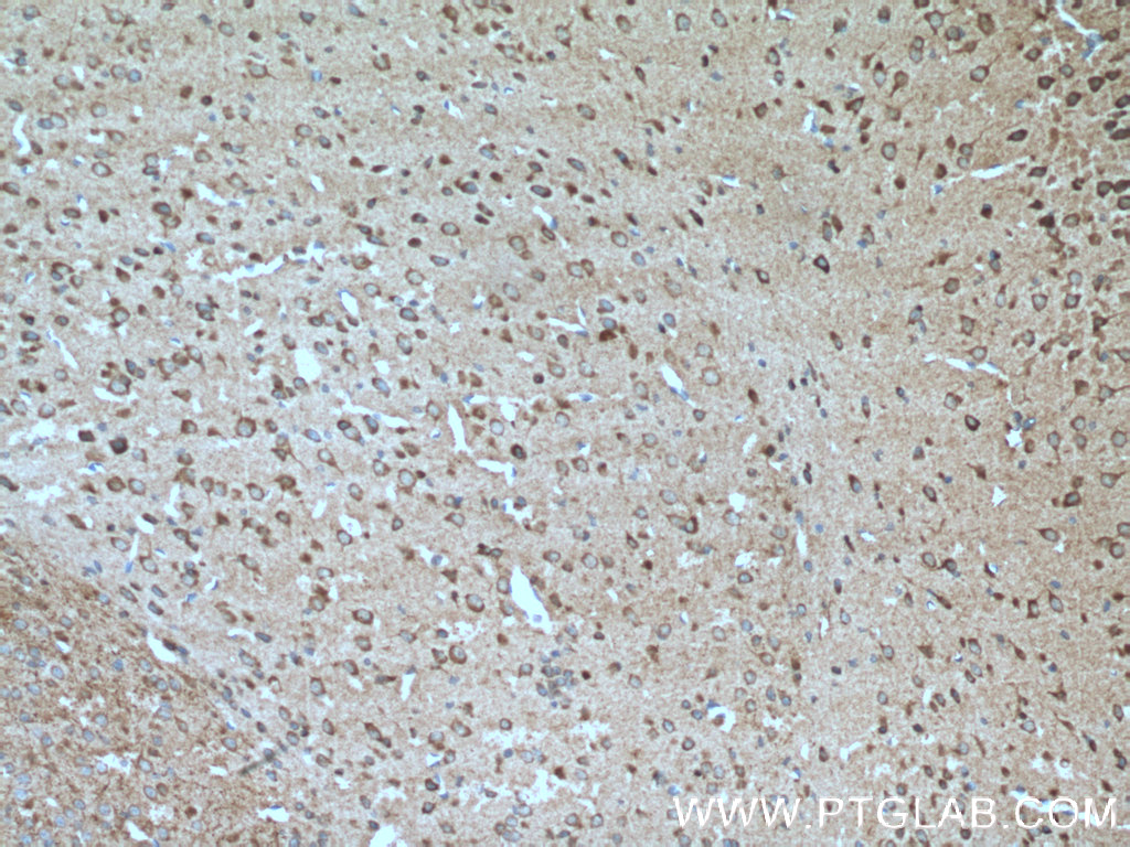 IHC staining of mouse brain using 13839-1-AP