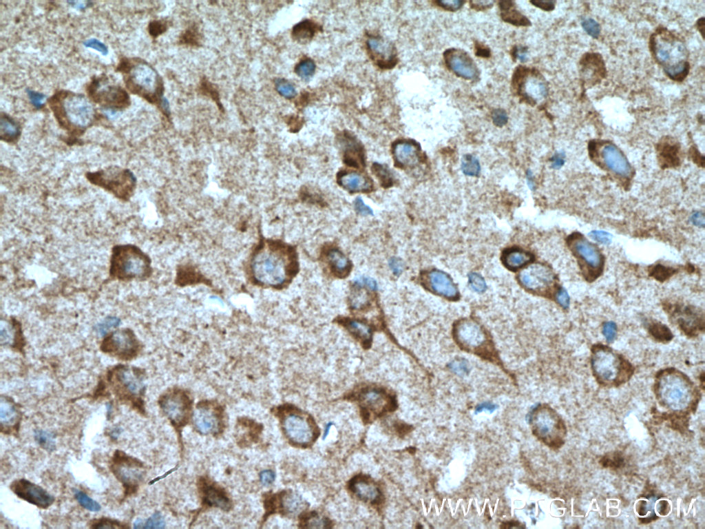 TAC1 Polyclonal antibody