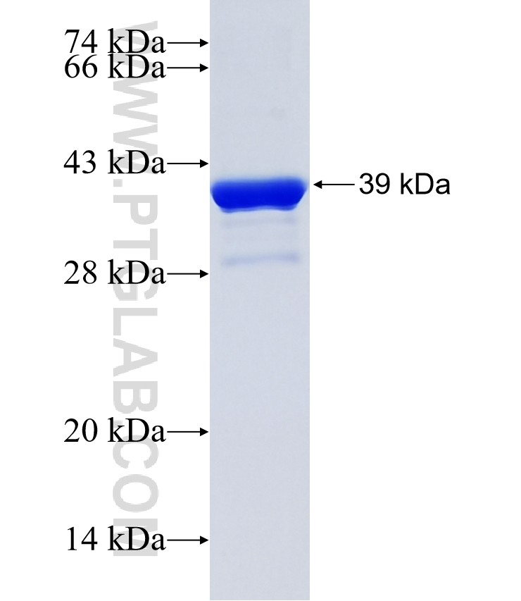 TAC3 fusion protein Ag2156 SDS-PAGE