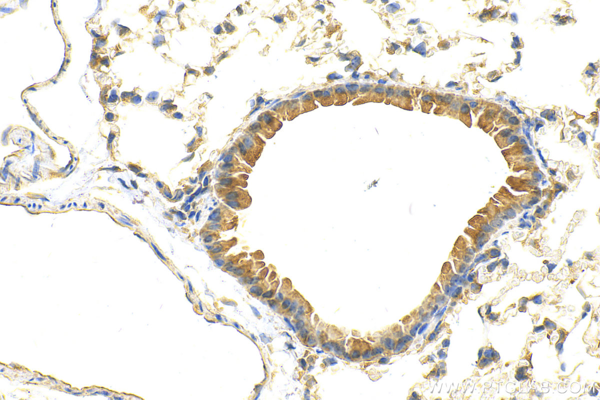IHC staining of mouse lung using 21232-1-AP