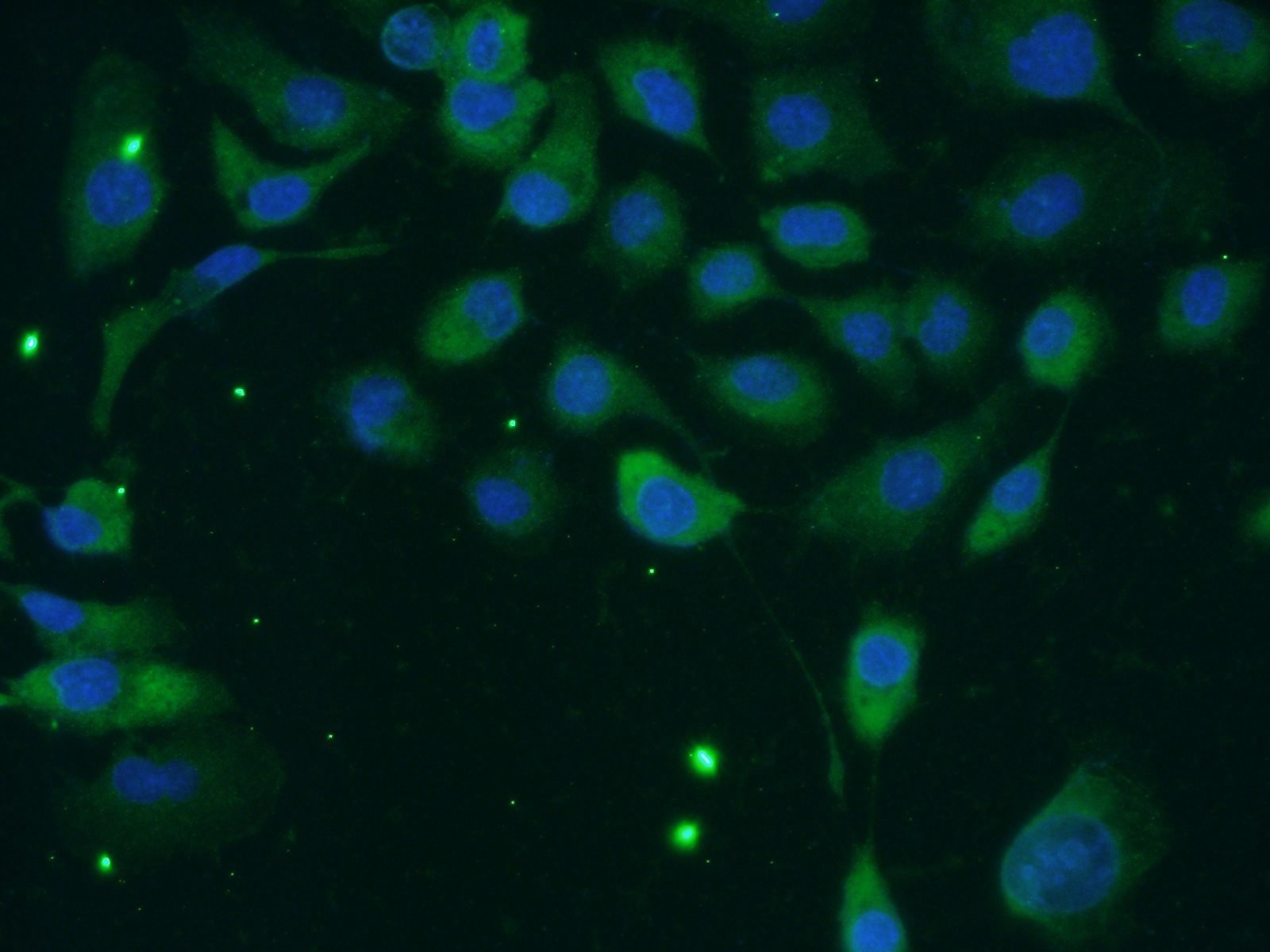 IF Staining of A431 using 11407-1-AP