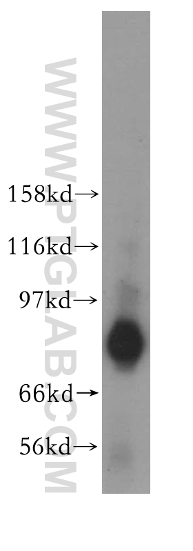 WB analysis of mouse testis using 11407-1-AP