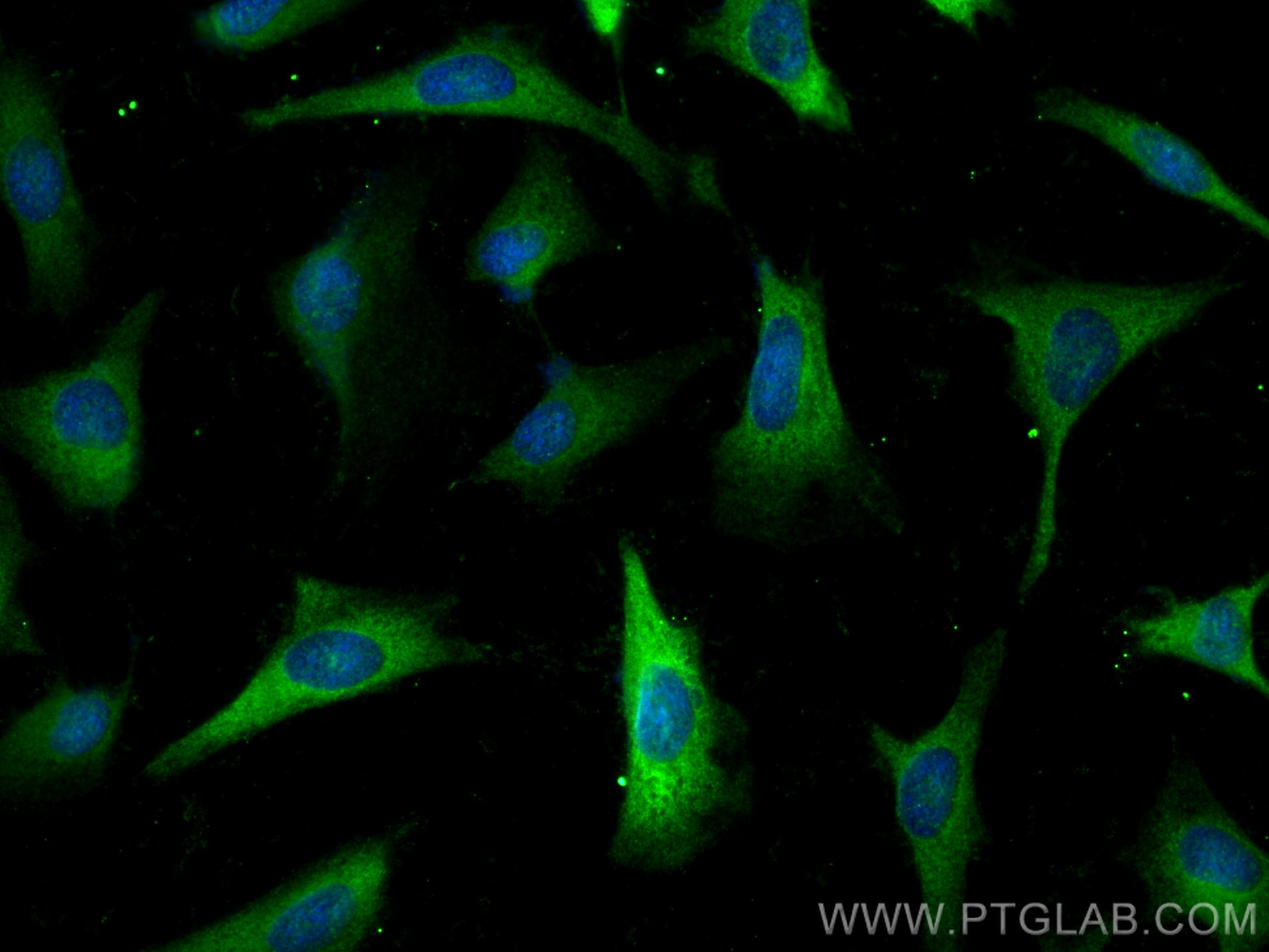 IF Staining of HeLa using 25697-1-AP