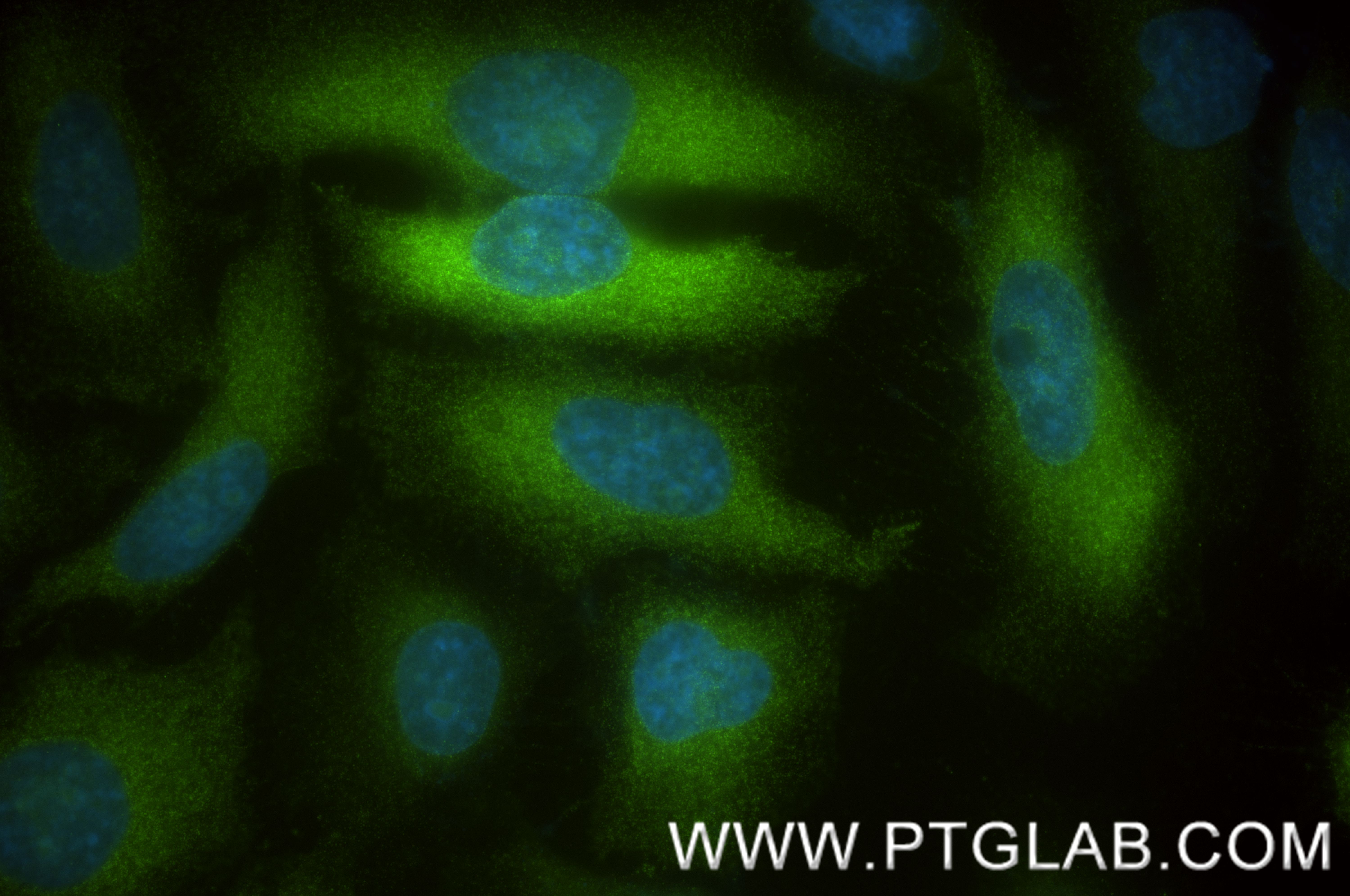 IF Staining of HeLa using 84940-5-RR