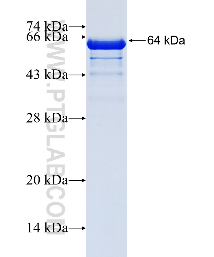 TACC3 fusion protein Ag22516 SDS-PAGE