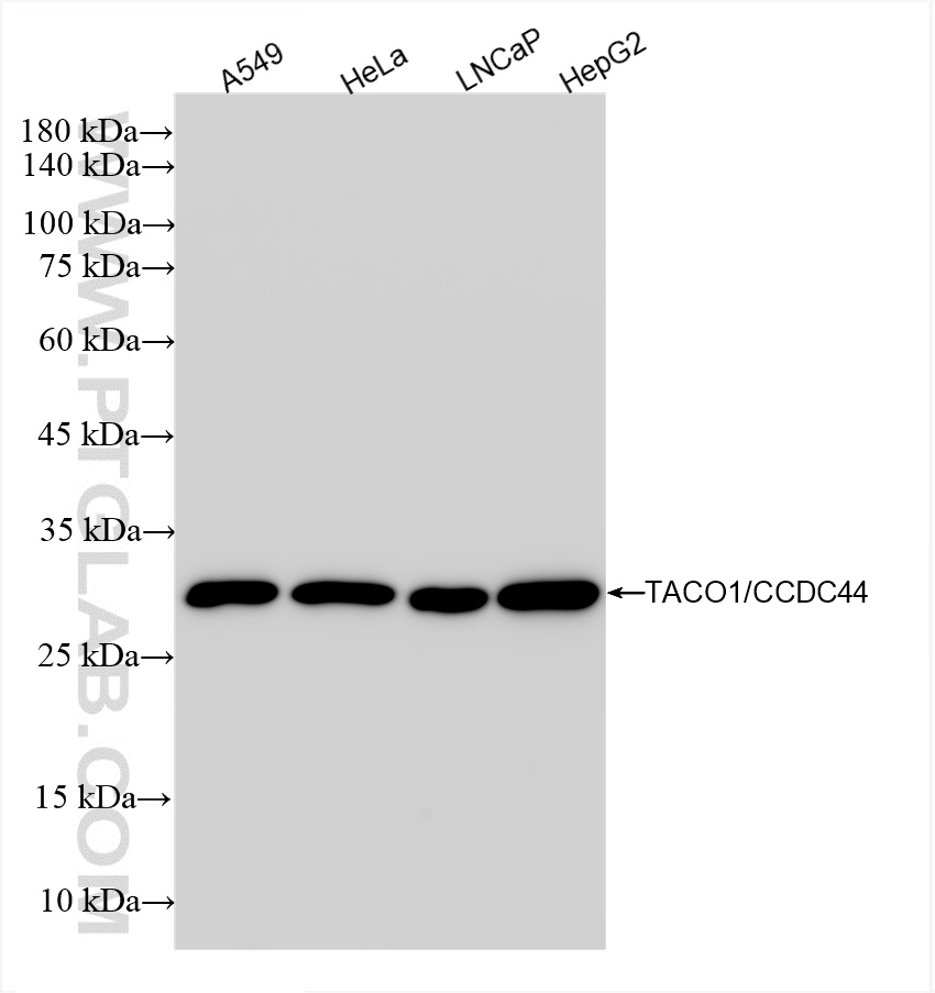 WB analysis using 85625-1-RR