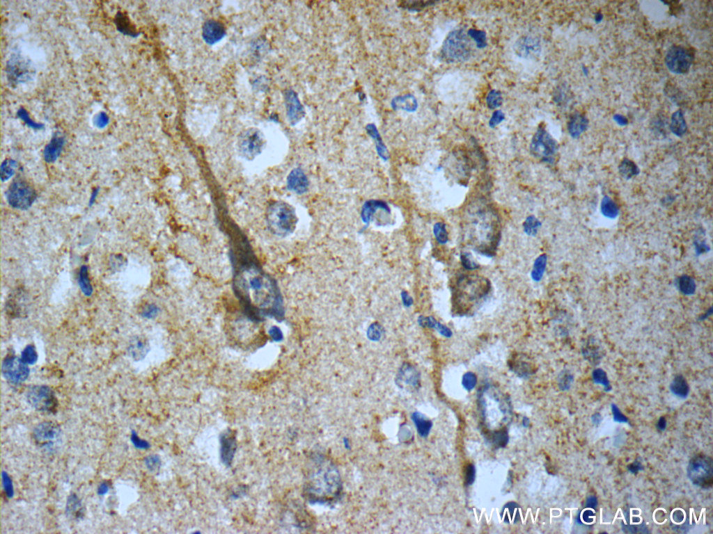 TACR3 Polyclonal antibody