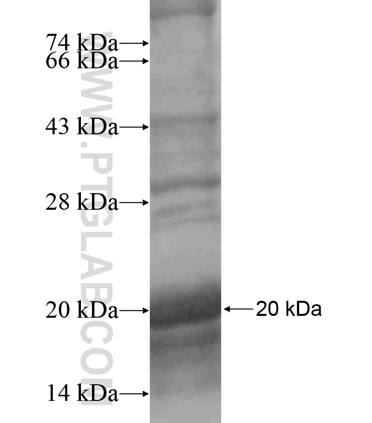 TACR3 fusion protein Ag17893 SDS-PAGE TACR3 fusion protein Ag17893 SDS-PAGE