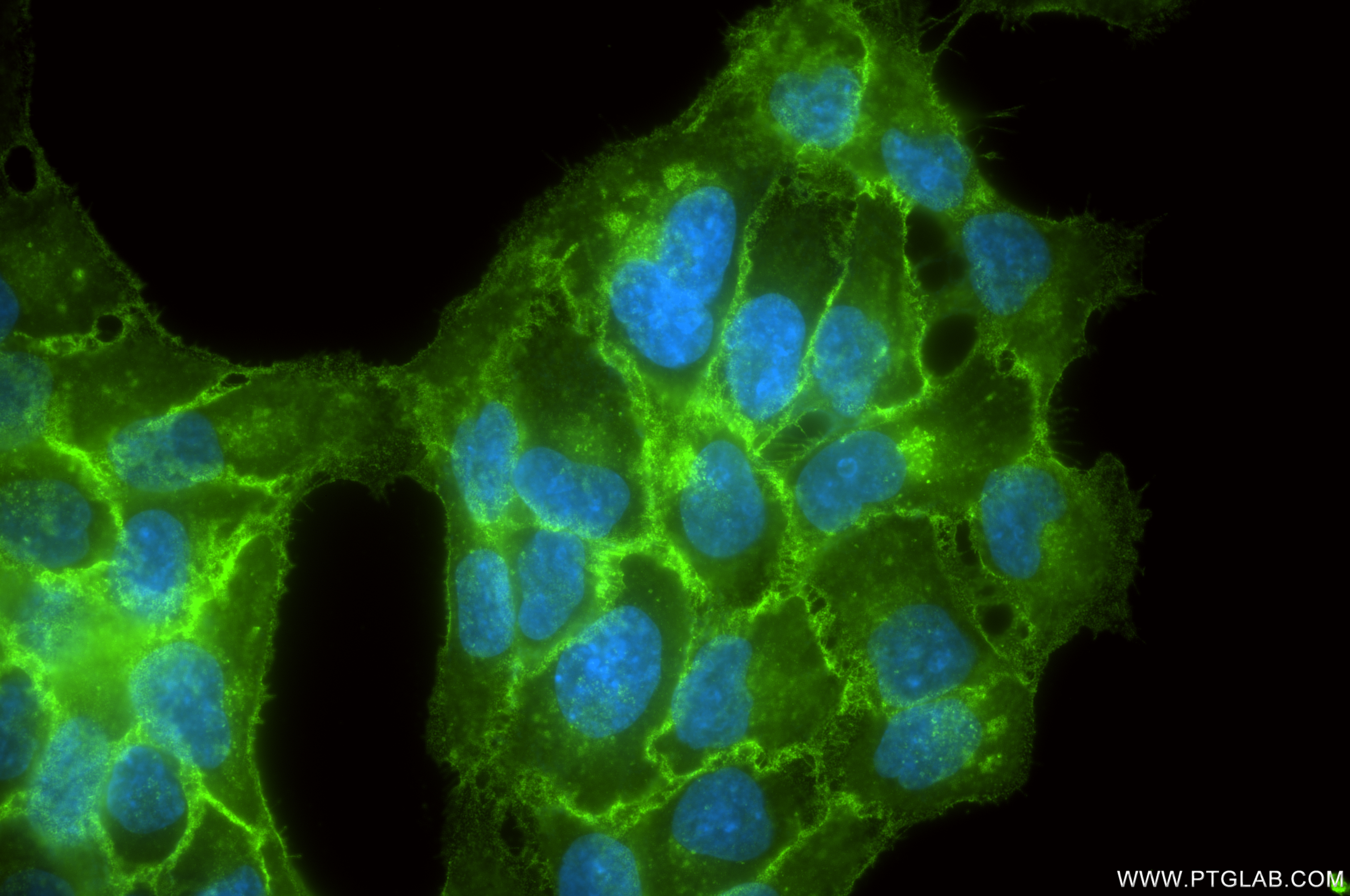 Immunofluorescent analysis of (-20°C Methanol) fixed HaCaT cells using TACSTD2/TROP2 antibody (86155-1-RR, Clone: 250382C9 ) at dilution of 1:1000 and CoraLite®488-Conjugated Goat Anti-Rabbit IgG(H+L) (<a class='green' href='/productredirect?CatalogNo=SA00013-2' target='_blank'>SA00013-2</a>). IF Staining of HaCaT using 86155-1-RR