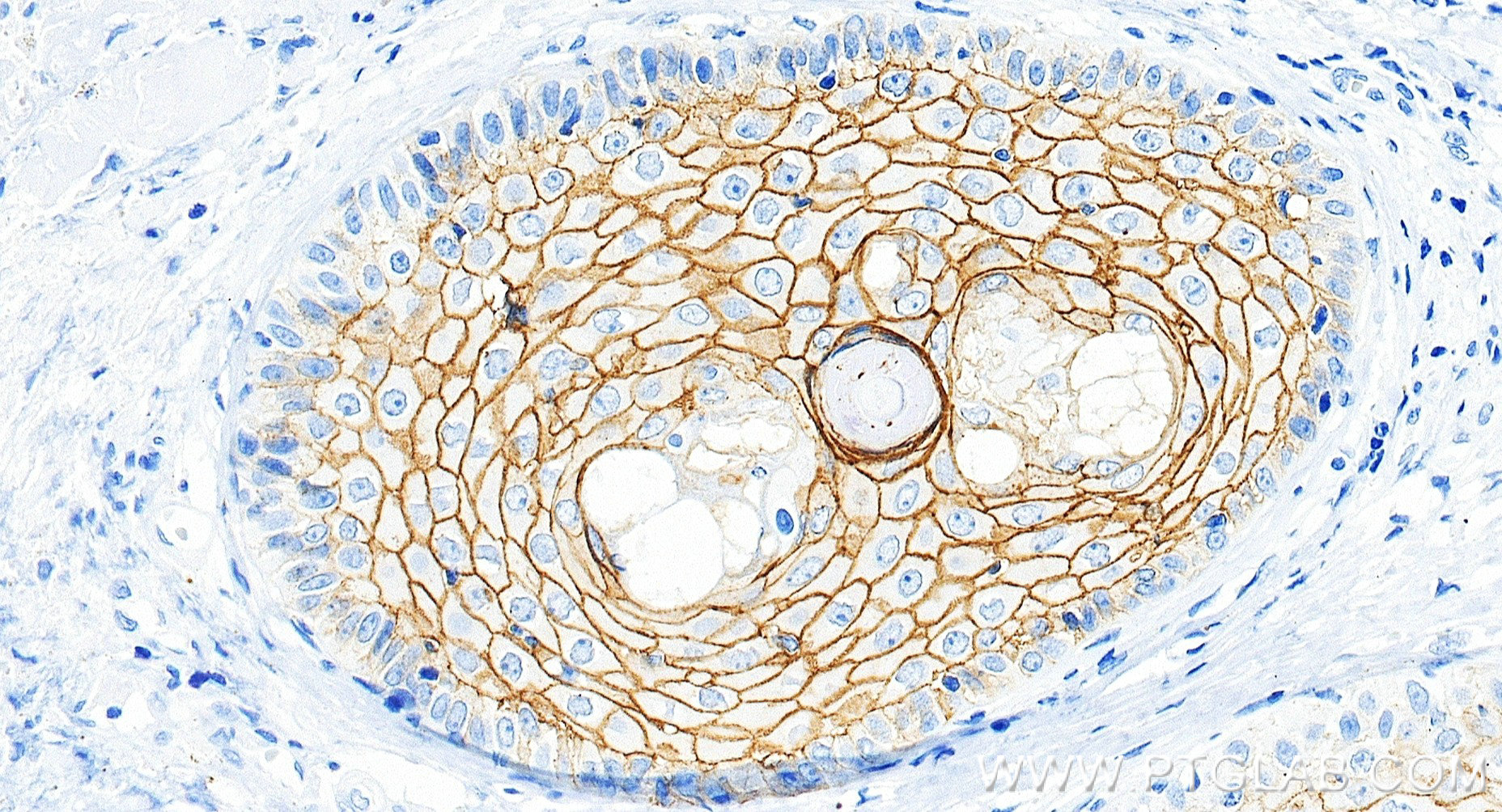 IHC staining of human skin using 86155-1-RR
