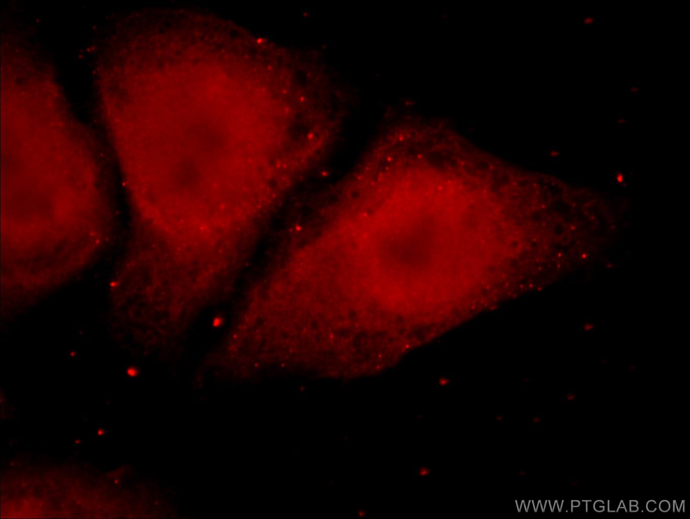 IF Staining of HepG2 using 20337-1-AP