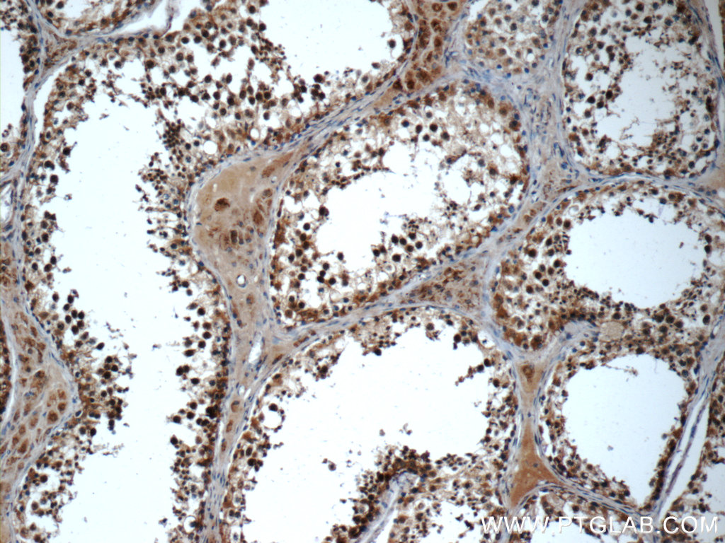 IHC staining of human testis using 20337-1-AP (same clone as 20337-1-PBS)