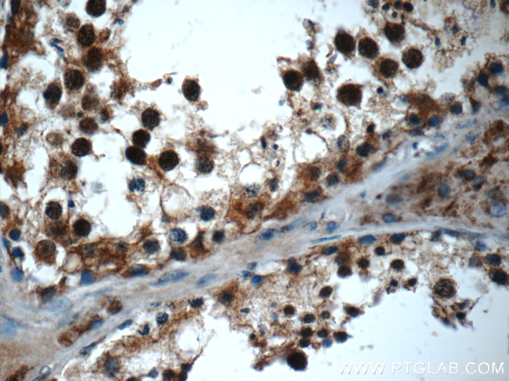 IHC staining of human testis using 20337-1-AP (same clone as 20337-1-PBS)