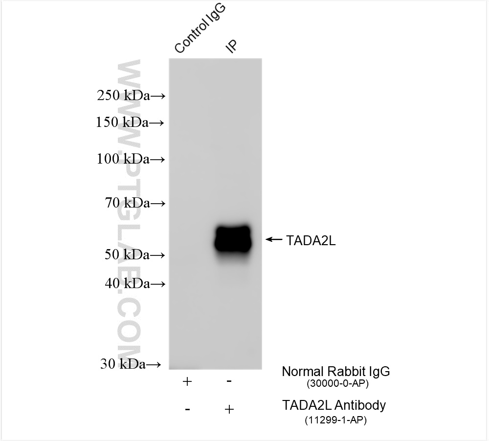 IP experiment of mouse testis using 11299-1-AP