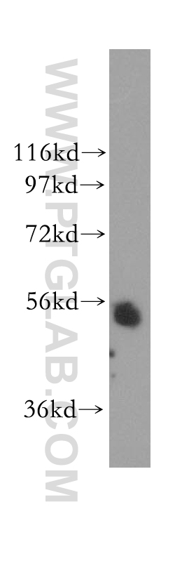 WB analysis of mouse testis using 11299-1-AP